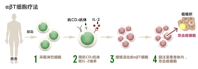 αβT細胞療法