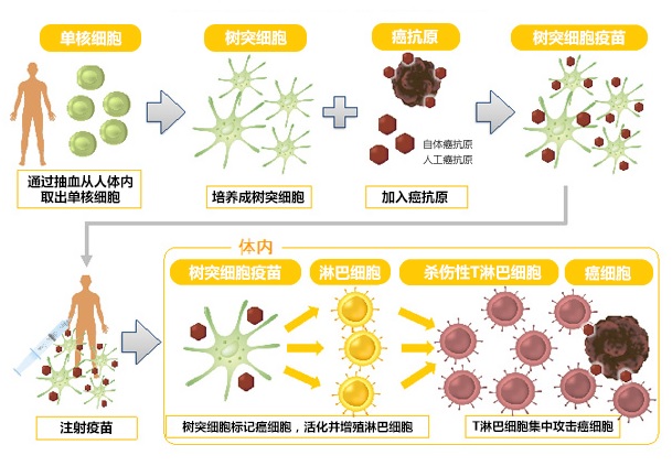 樹突細胞疫苗治療流程