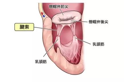 人工肌腱移植