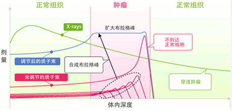 質子重離子治療優勢2